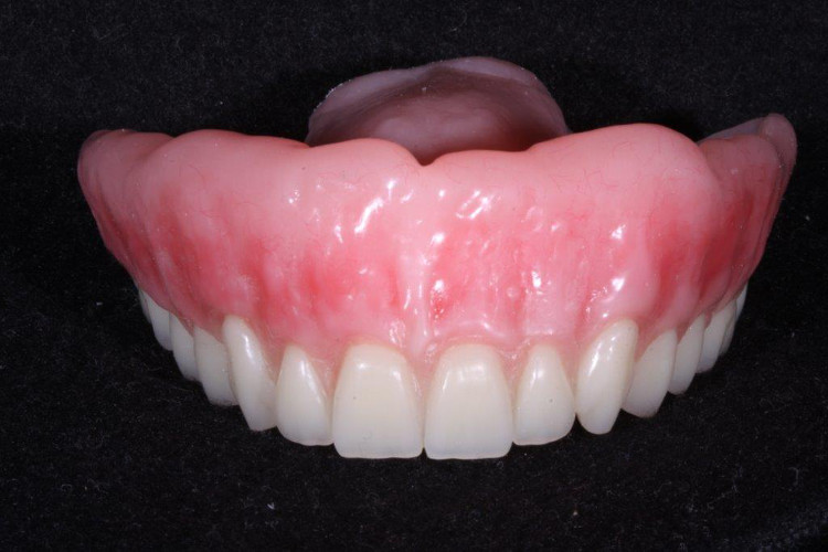 Cosmetic Dentures | Dentist in Brooklyn Center | Brooklyn Blvd Dental