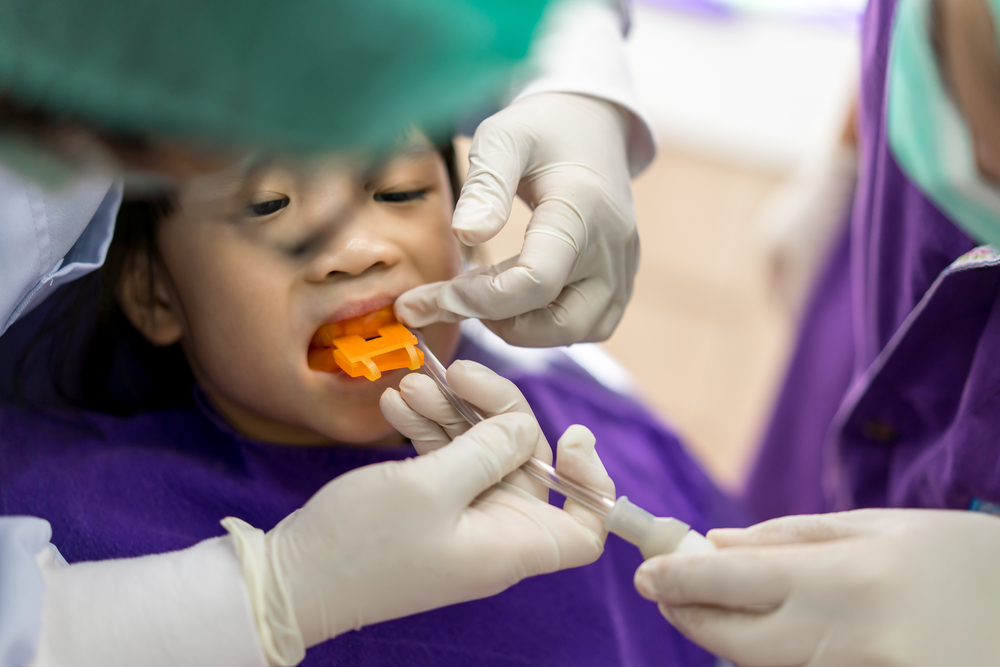 Fluoride Applications | Dentist in Brooklyn, MN | Brooklyn Blvd Dental